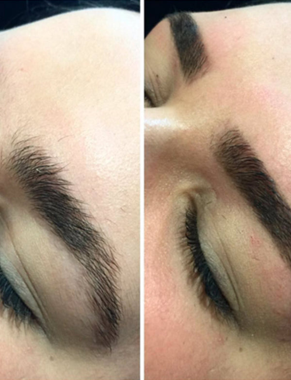 Eyebrow Makeover vs Feather Touch Tattooing