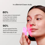 Omnilux Blemish Eraser Mini LED